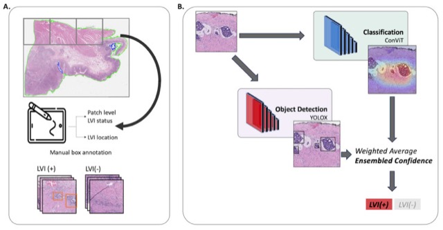 Schematic of the LVI Net preprocessing and model workflow