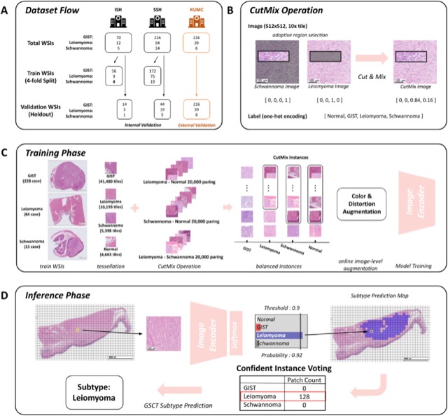 Figure 1 from the gastric spindle cell tumor classification study